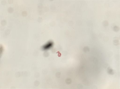 Licnophora?