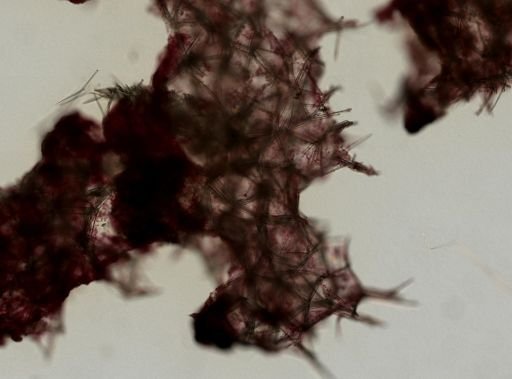 Myxilla perspinosa