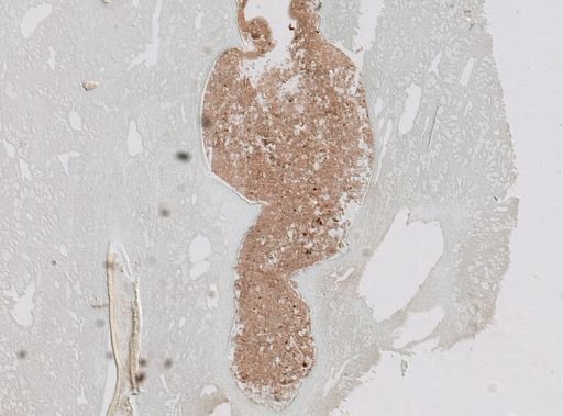 Ianthella sp.
