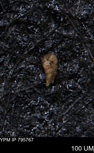 Verneuilina canadensis