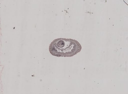 Lineus sanguineus