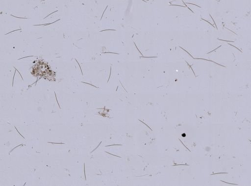 Haliclonidae