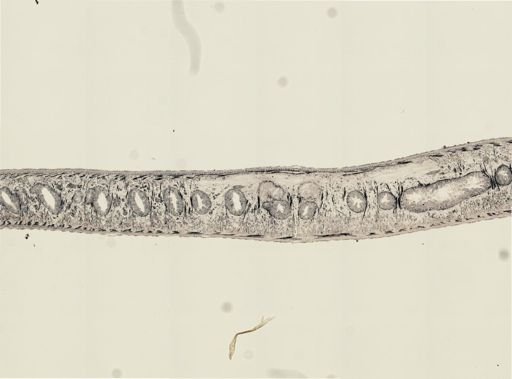 Turbellaria