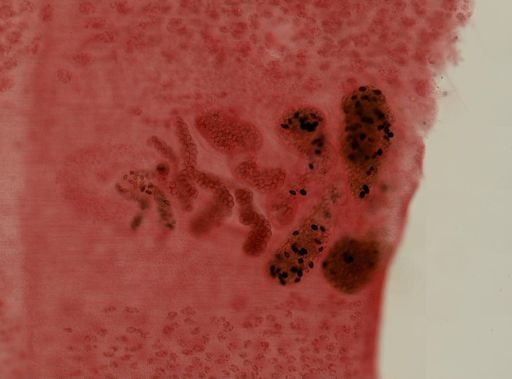 Diphyllobothrium latum