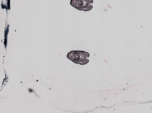 Plagiostomum whitmani