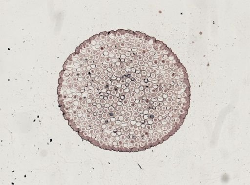 Ascaris