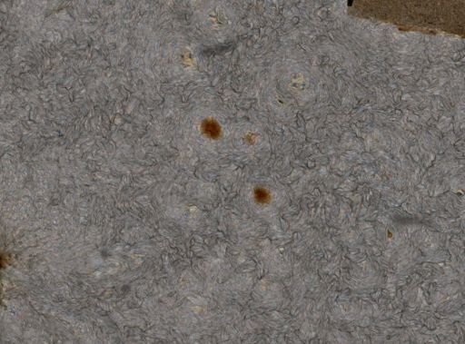 Lepadella patella