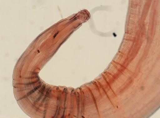 Oligacanthorhynchus microcephalus