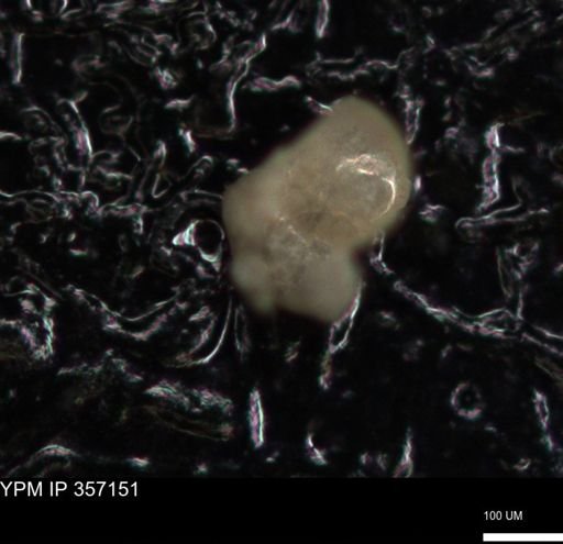 undet. Foraminiferida