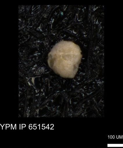 undet. Foraminiferida