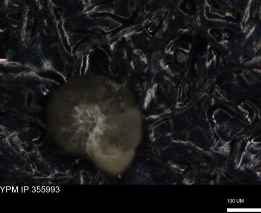 undet. Foraminiferida