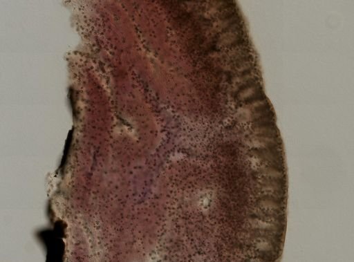 Chondrilla