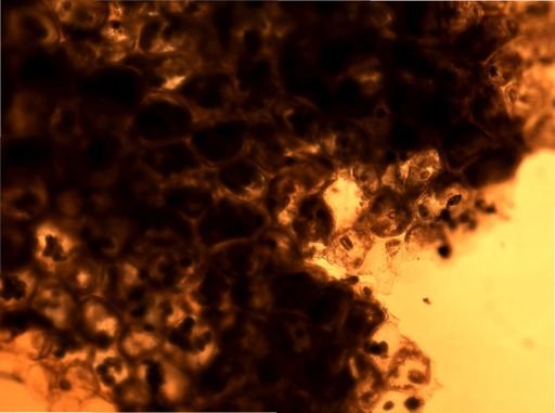 Alcyonidium