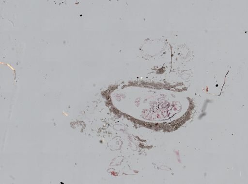 Leucosolenia