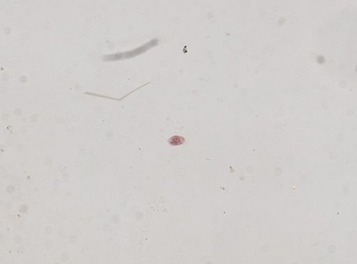 Oxytricha