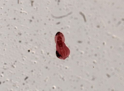 Posthodiplostomum minimum