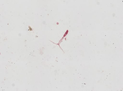 Cercaria gracillima