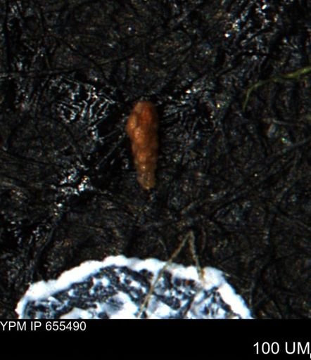 Verneuilina canadensis