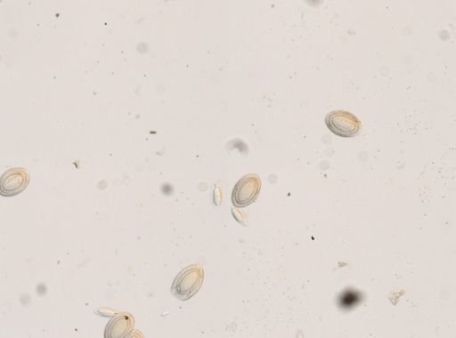 Macracanthorhynchus hirudinaceus