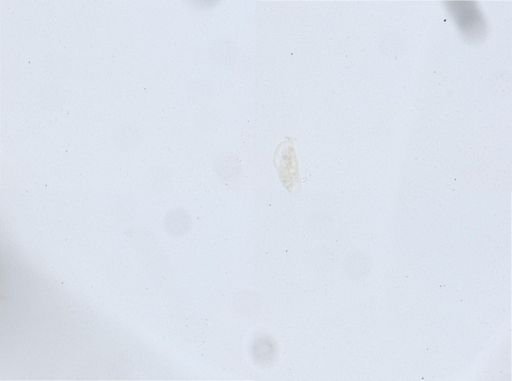 Woodruffia metabolica