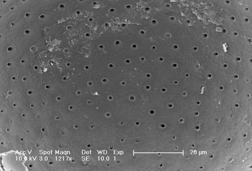 Globigerinella siphonifera