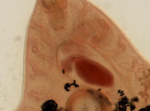 Fasciola hepatica