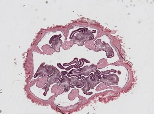 Edwardsia sp.