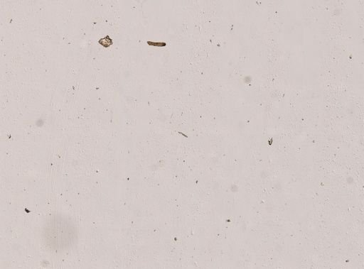 Epitomapta roseola