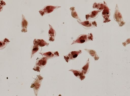 Epiphanes senta