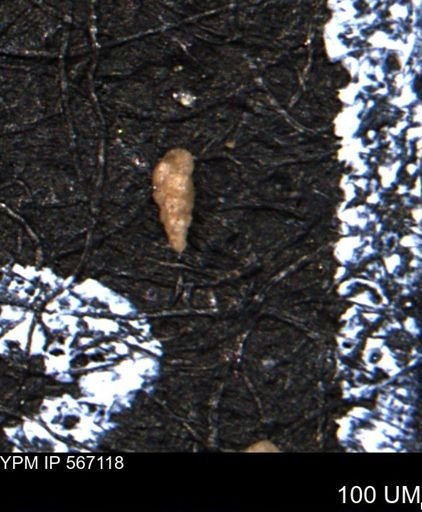 Verneuilina canadensis