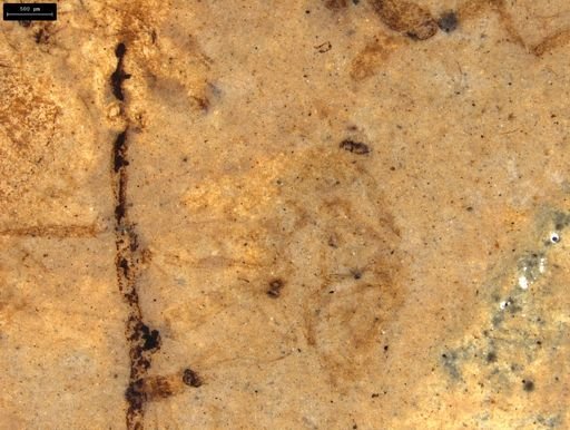 undet. Arachnida