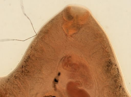 Fasciola hepatica