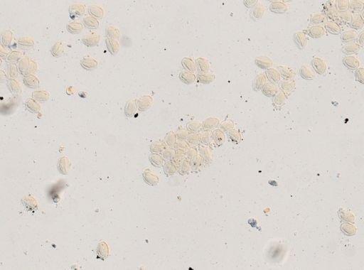 Ascaris lumbricoides
