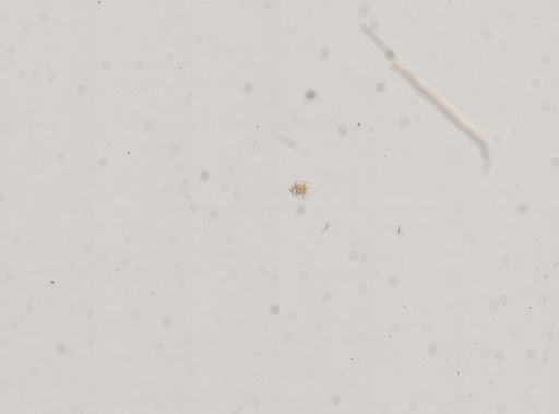 Brachionus patulus