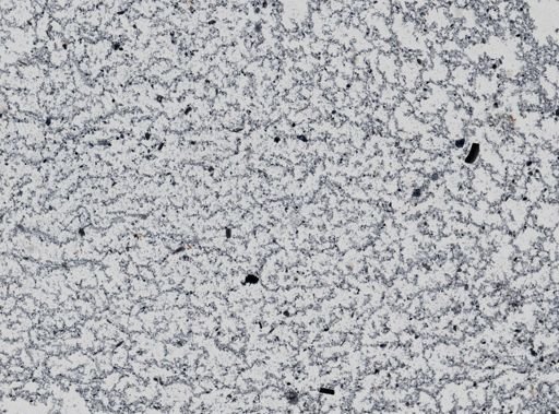 Giardia lamblia