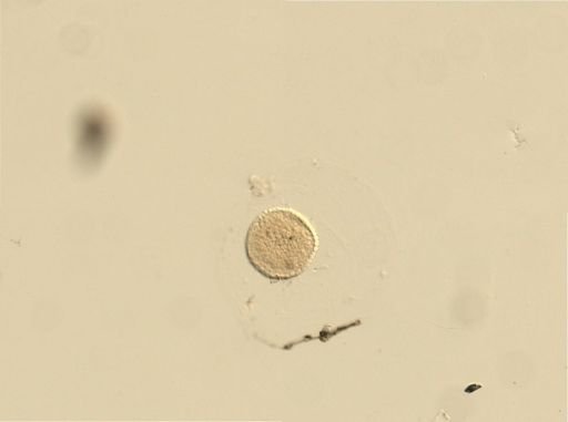 Branchiostoma
