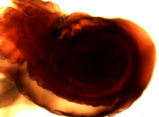 Taenia solium