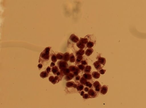 Echinococcus granulosus