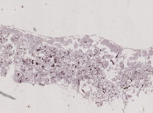 Clathria prolifera