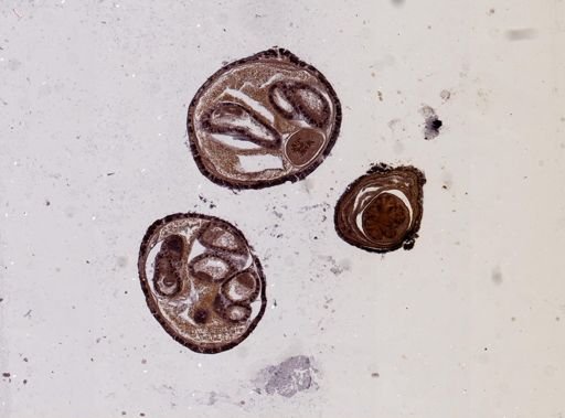 Prosadenoporus agricola