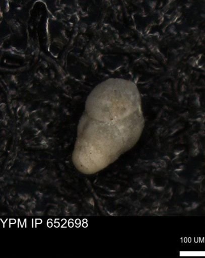 undet. Foraminiferida