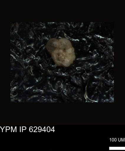 undet. Foraminiferida