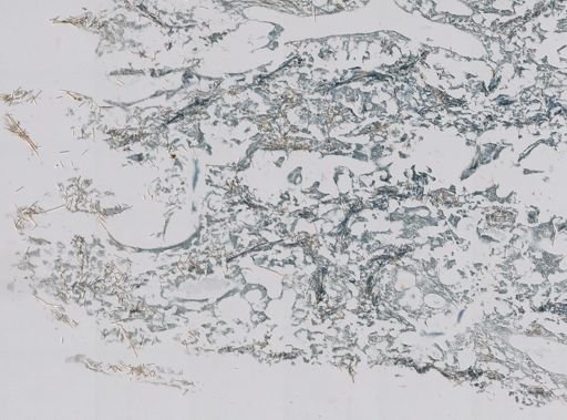 Neofibularia nolitangere