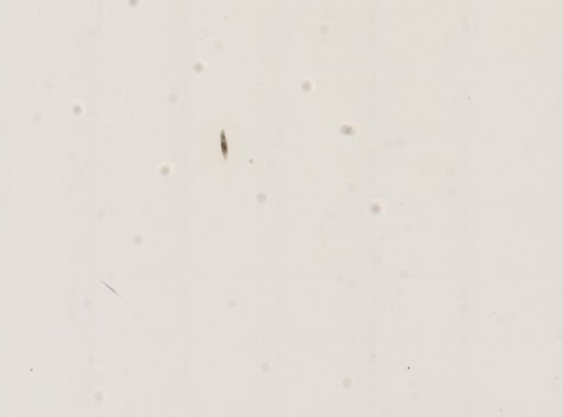 Paramecium