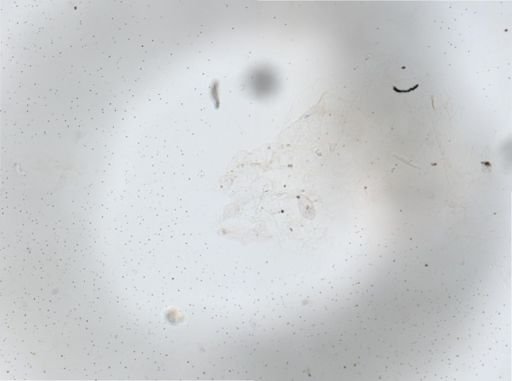 Paramecium