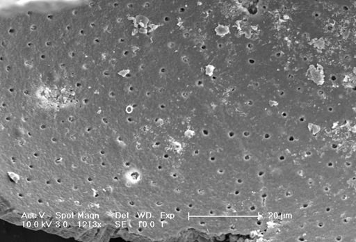 Globigerina bulloides