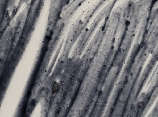 Entamoeba histolytica