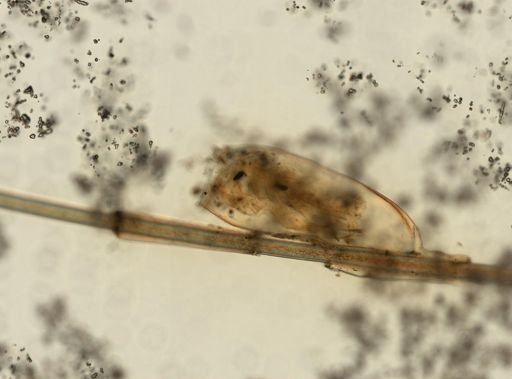 Pediculus humanus
