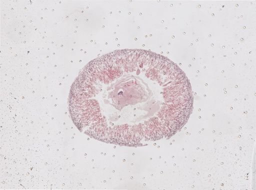Lithobius forficatus