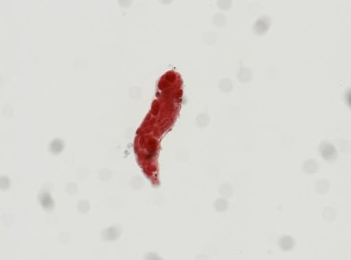 Digenea